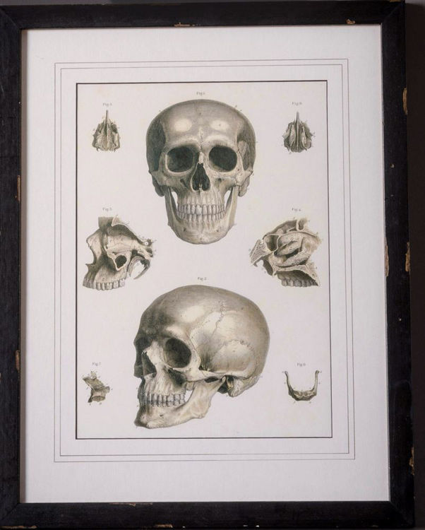 Picture of Anatomical Skull